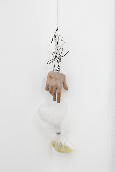 Stuart Middleton, *Man with Carpal Tunnel*, 2014, Resin, wire, modelling clay, plastic funnel, plastic bag